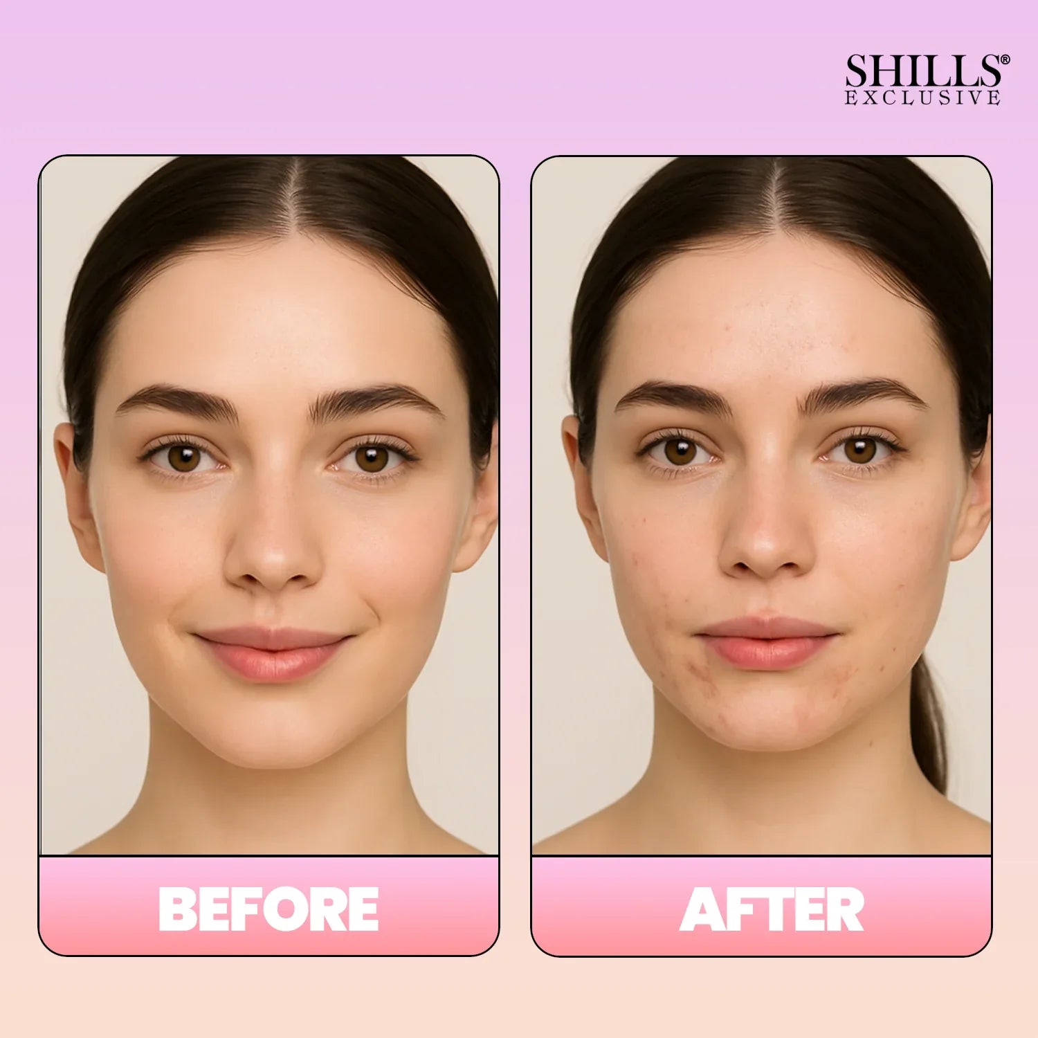 Makeup Remover Mist - Shills Professional