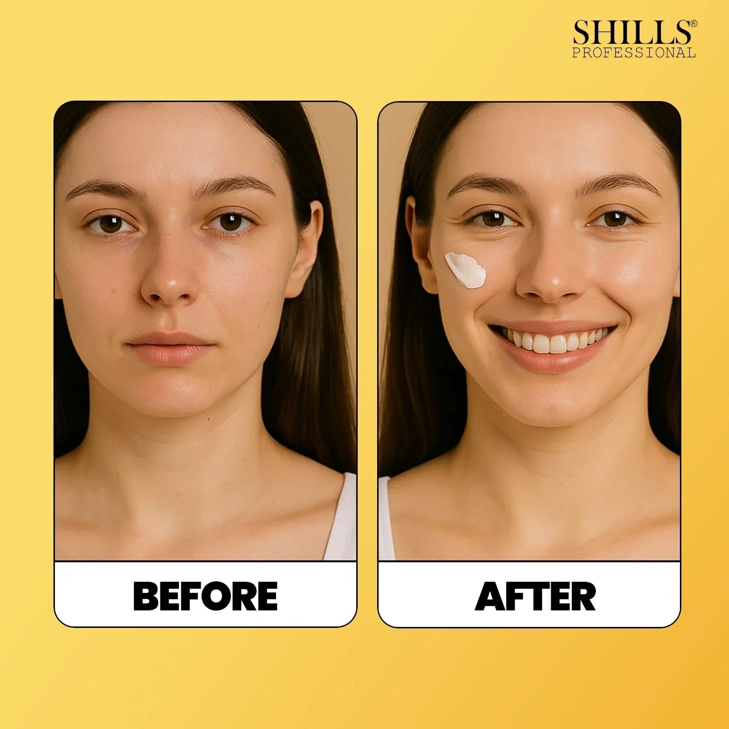 Sun Screen - Shills Professional