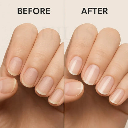 12 In 1 Nail Therapy - Shills Professional