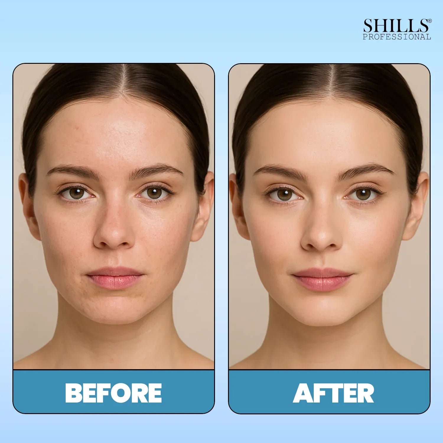 Hydra Boost Water Moisturizing Toner - Shills Professional